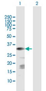 CSGALNACT1 Polyclonal Antibody, MaxPab™