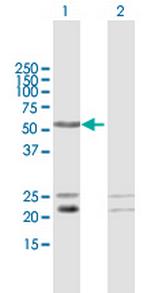 C1orf103 Polyclonal Antibody, MaxPab™