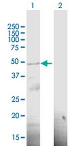RP11-98F14.6 Polyclonal Antibody, MaxPab™