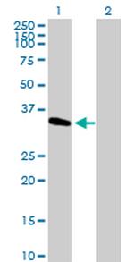 METTL2 Antibody in Western Blot (WB)