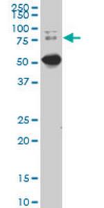 DCP1A Monoclonal Antibody (2F11)