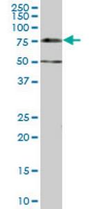 DCP1A Antibody in Western Blot (WB)