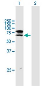 ST6GALNAC1 Polyclonal Antibody, MaxPab™