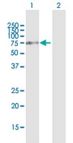 FOXJ2 Antibody in Western Blot (WB)