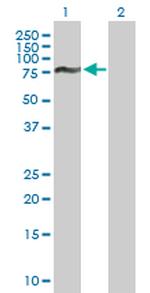 FOXJ2 Antibody in Western Blot (WB)