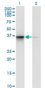 TSNAXIP1 Monoclonal Antibody (1D6)