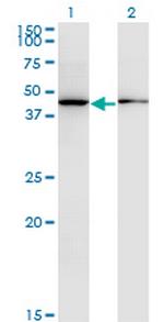 ALLC Monoclonal Antibody (3D3)