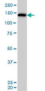 CAND1 Monoclonal Antibody (5D7)