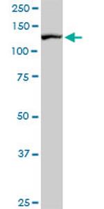 CAND1 Antibody in Western Blot (WB)