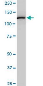 CAND1 Antibody in Western Blot (WB)