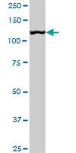 CAND1 Antibody in Western Blot (WB)