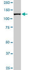 CAND1 Antibody in Western Blot (WB)