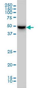 MDS028 Monoclonal Antibody (1B7)