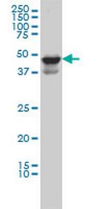MDS028 Monoclonal Antibody (2E8)