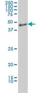 MDS028 Antibody in Western Blot (WB)