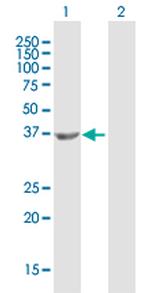 HDAC8 Antibody in Western Blot (WB)