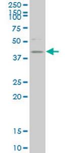 HDAC8 Monoclonal Antibody (2F4)