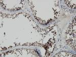 PBK Antibody in Immunohistochemistry (Paraffin) (IHC (P))