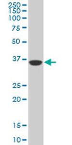 PBK Antibody in Western Blot (WB)
