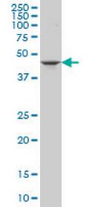 GSDML Monoclonal Antibody (4C10)