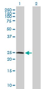 ZNF313 Polyclonal Antibody, MaxPab™