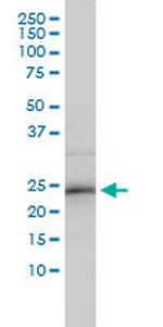 ZNF313 Monoclonal Antibody (4G3-1A10)