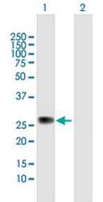 ZC4H2 Polyclonal Antibody, MaxPab™
