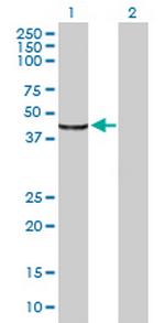 MYO5C Antibody in Western Blot (WB)