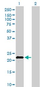 APOM Antibody in Western Blot (WB)