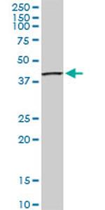 SEPT3 Antibody in Western Blot (WB)