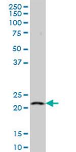 RAG1AP1 Antibody in Western Blot (WB)