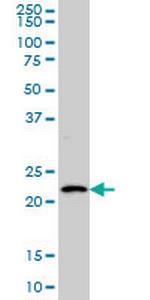 BARX1 Monoclonal Antibody (3C11)