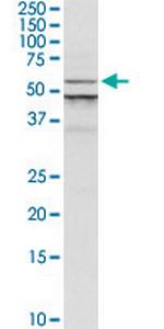 ALG1 Polyclonal Antibody, MaxPab™