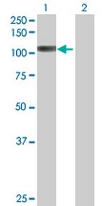 PCDHB6 Antibody in Western Blot (WB)