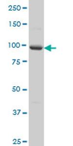 PCDHA5 Antibody in Western Blot (WB)