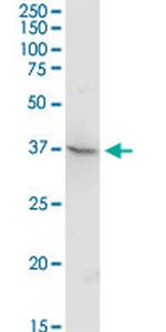 TEX13A Antibody in Western Blot (WB)