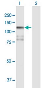 STK31 Antibody in Western Blot (WB)