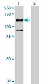 STK31 Antibody in Western Blot (WB)