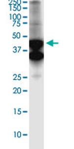 SERTAD4 Antibody in Western Blot (WB)