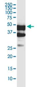 SERTAD4 Antibody in Western Blot (WB)