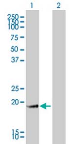 GKN1 Monoclonal Antibody (2E5)
