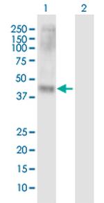 SLC7A10 Polyclonal Antibody, MaxPab™