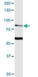 TRPV5 Monoclonal Antibody (2A6)