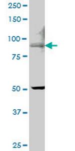 TRPV5 Monoclonal Antibody (6D6)