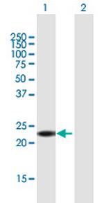 ANKRD7 Antibody in Western Blot (WB)