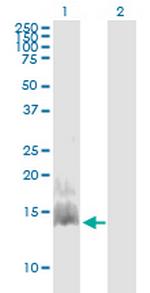 CCL28 Monoclonal Antibody (3A7)