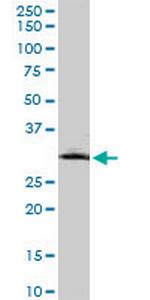 MMP26 Monoclonal Antibody (6C6)