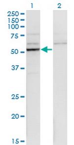 CYP26B1 Monoclonal Antibody (1H6)