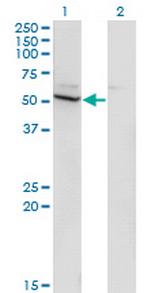 CYP26B1 Monoclonal Antibody (2G7)