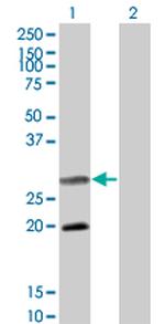 DIABLO Antibody in Western Blot (WB)